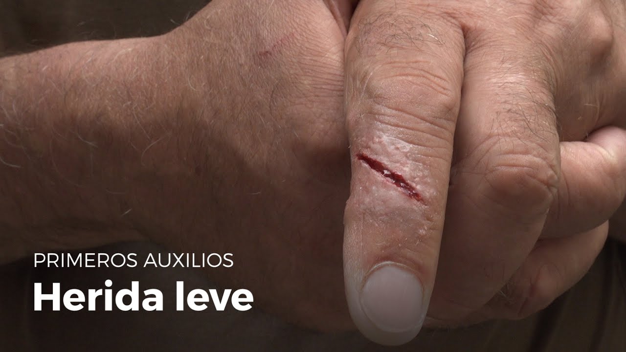 como curar heridas en los dedos delas manos